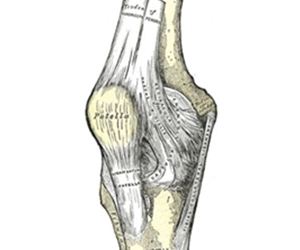 Articulação  do joelho. Como tratar artrose.